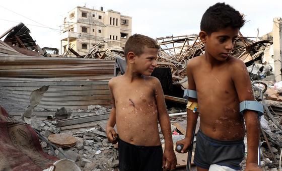 الطفلان زين وجود من عائلة الأنقر مصابان بجروح ظاهرة جراء انفجار جسم من مخلفات الحرب في غزة.